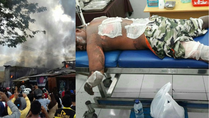Korban yang mengalami luka bakar akibat kebakaran di Pasar Cita