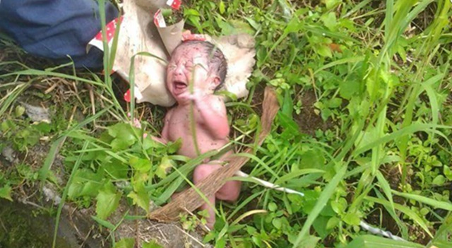 Kondisi bayi saat dtemukan tergeletak di tanah berumput