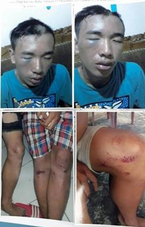 Korban yang babak belur dianiaya (Foto diberikan oleh Ketua KPAI RI Wilayah Sulawesi Utara, Adv. E.K Tindangen SH)