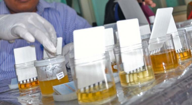 Uji Bebas Narkoba Kalangan Pejabat Minsel Masih Terbentur Anggaran 8 Uji Bebas Narkoba Kalangan Pejabat Minsel Masih Terbentur Anggaran