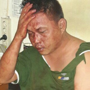 Ini Kronologi, Tabrakan Beruntun.