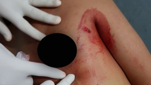 Hah !!! Pembonceng Tikam Pengendara, Polsek Modoinding Kejar Pelaku