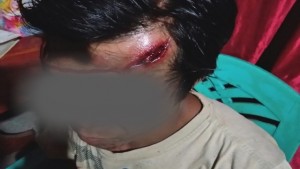 Astaga !!! Tukang Asal Tomohon Dianiaya Lelaki Tenga
