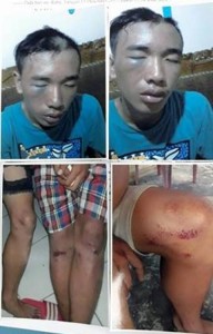 Sadis !!! Tanpa Alasan Jelas Lima Remaja Babak Belur Dianiaya Puluhan Sabhara Polda Sulut