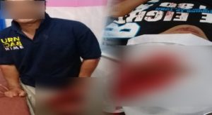 Duel Maut, 2 Warga Tompasobaru Masuk Rumah Sakit