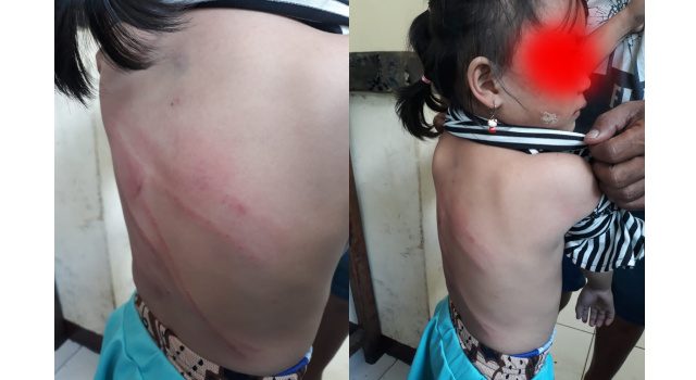 Pukul Anak Hingga Lebam, Meyta Dipolisikan 8 Pukul Anak Hingga Lebam, Meyta Dipolisikan