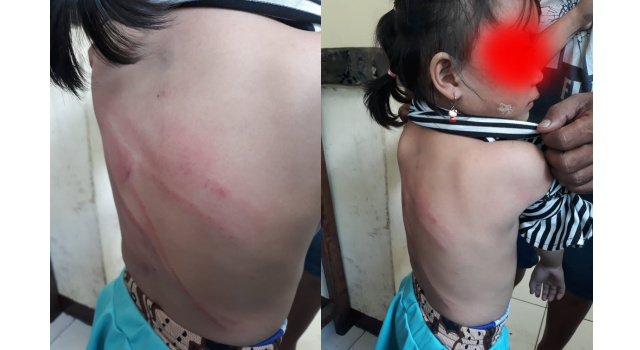 Pukul Anak Hingga Lebam, Meyta Dipolisikan