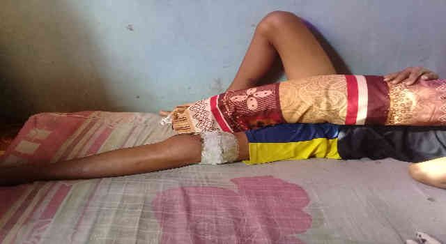 Sadis!!! Hanya Karena Coret Baliho, Anak Ini Diculik dan Dipukul Hingga Kakinya Patah