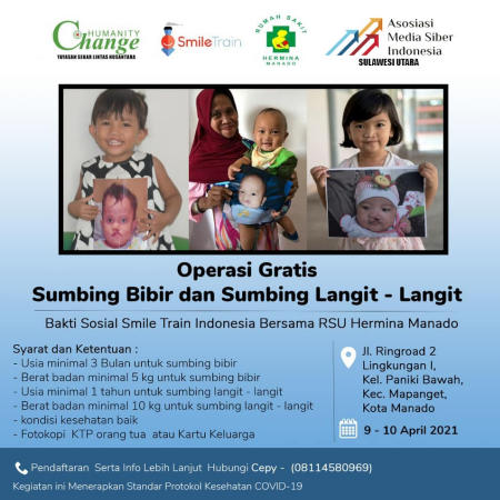 Smile Train Indonesia, RSU Hermina Manado, dan AMSI Sulut Gelar Operasi Celah Bibir dan Langit-Langit