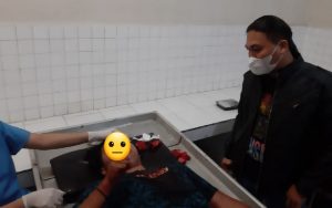 “Bagara Ompong”, Rendy Terima Tebasan di Dahi