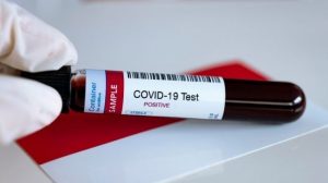 Tak Perlu Hasil PCR Negatif, Begini Syarat Pasien Covid-19 Dinyatakan Sembuh