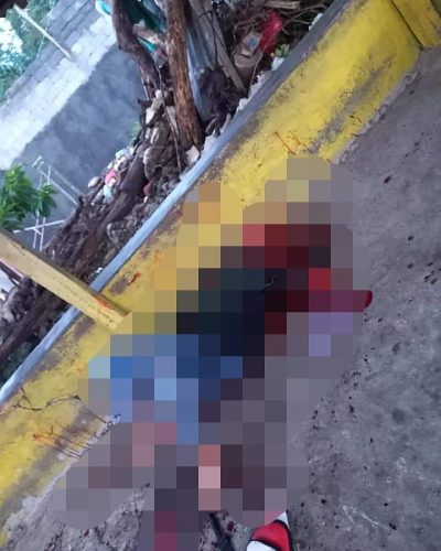 Kedua Tangan Lelaki Asal Pakuure Tiga Dipotong Hingga Putus, Tersangka Melarikan Diri