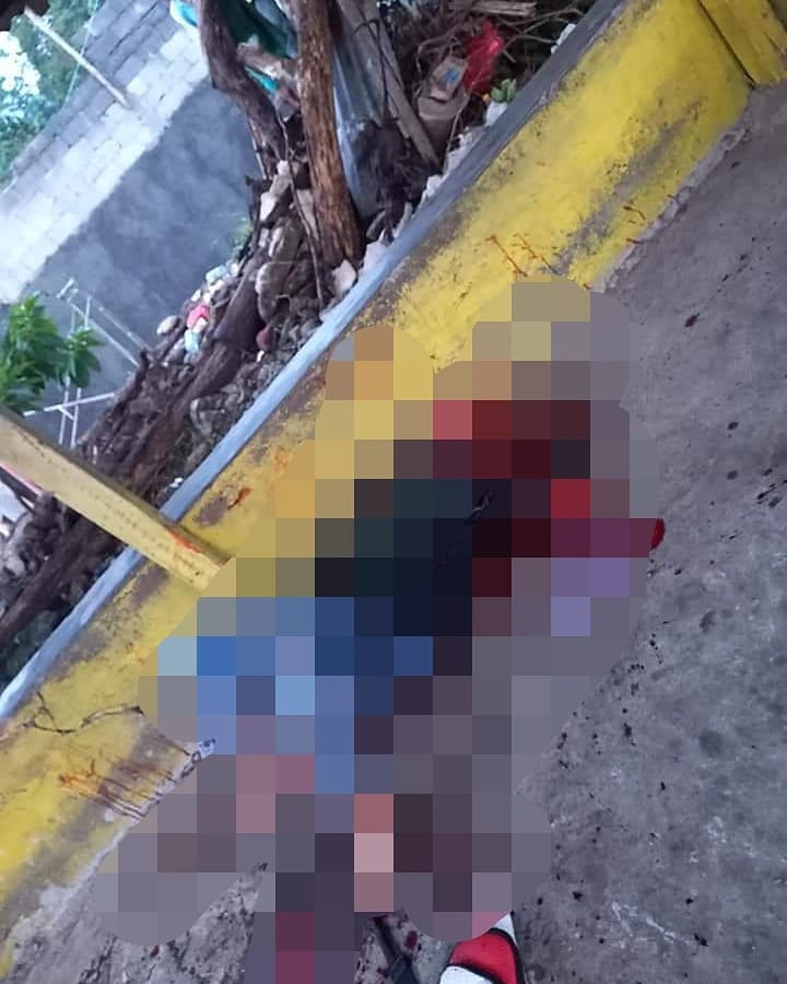 Kedua Tangan Lelaki Asal Pakuure Tiga Dipotong Hingga Putus, Tersangka Melarikan Diri