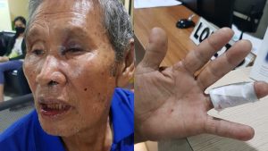 Opa 76 Tahun Dianiaya Pria Bertato, Pelaku Langsung Diringkus Polisi