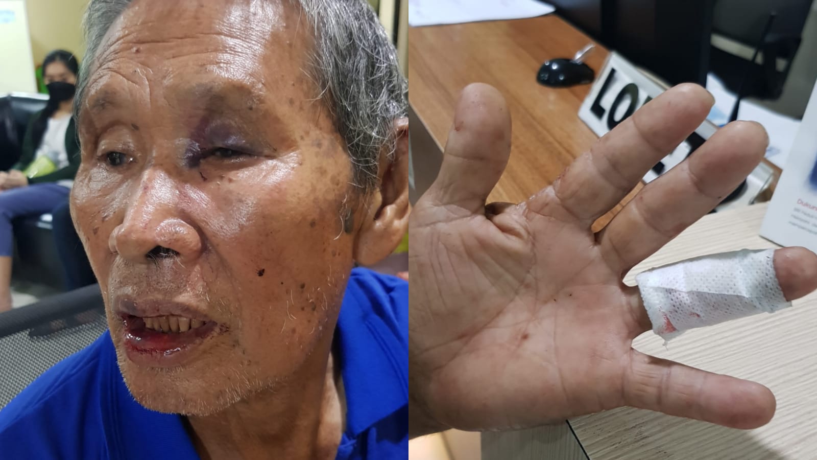 Opa 76 Tahun Dianiaya Pria Bertato, Pelaku Langsung Diringkus Polisi