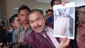 Komnas HAM Sudah Kantongi Jawaban Penyebab Luka di Jasad Brigadir J