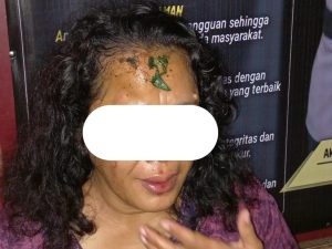 Dipengaruhi Miras, Warga Pusomaen Tega Aniaya Istrinya Sendiri