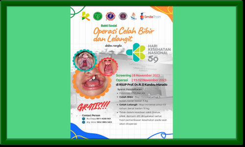RSUP Kandou Manado Akan Gelar Baksos Operasi Celah Bibir dan Lelangit, Simak Persyaratannya