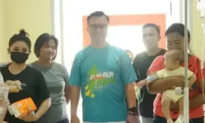 Baksos Operasi Bibir Sumbing Dimulai, Transformasi Layanan Sosial RSUP Kandou