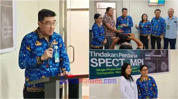 RSUP Kandou Manado Resmikan SPECT-MPI, Layanan Unggulan Deteksi Dini Jantung Paling Akurat