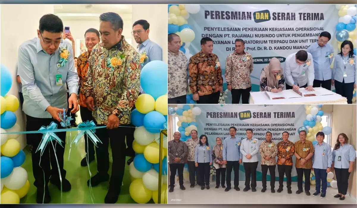 RSUP Kandou Resmikan Laboratorium Terpadu, Prof Starry Rampengan: Sudah Seperti “Little Singapore”