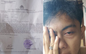 Korban Sudah Melapor, Pelaku Penganiayaan di Malalayang Beach Walk Masih Misterius