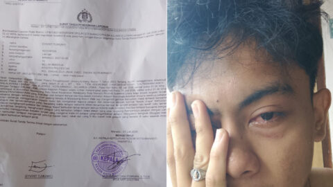 Korban Sudah Melapor, Pelaku Penganiayaan di Malalayang Beach Walk Masih Misterius