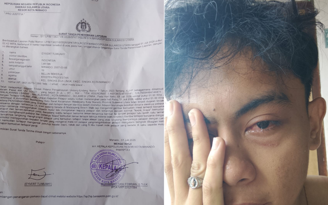 Korban Sudah Melapor, Pelaku Penganiayaan di Malalayang Beach Walk Masih Misterius