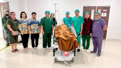 Direktur RS ODSK dr. David Kolibu bersama tim medis usai operasi perdana tumor usus besar di RS ODSK, Sulawesi Utara.